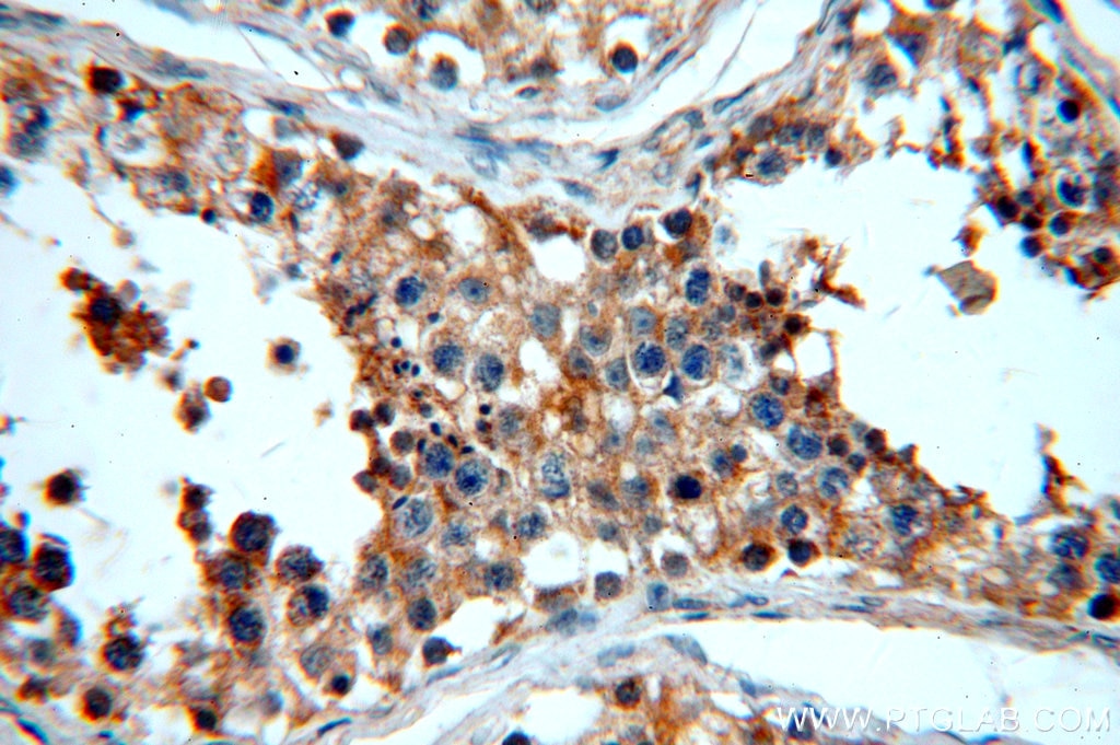 Immunohistochemistry (IHC) staining of human testis tissue using SLC16A12 Polyclonal antibody (20553-1-AP)