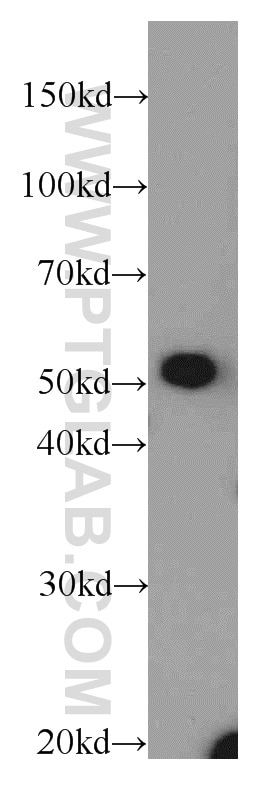 Western Blot (WB) analysis of mouse kidney tissue using SLC16A12 Polyclonal antibody (20553-1-AP)