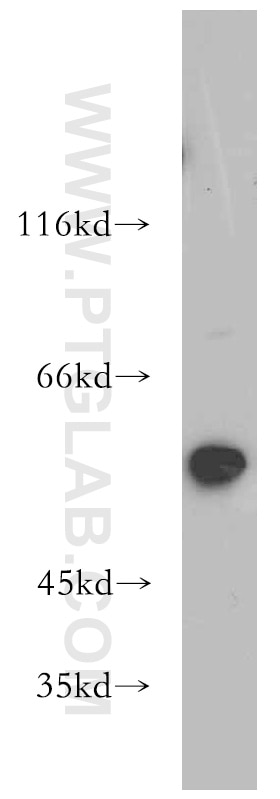 Western Blot (WB) analysis of mouse heart tissue using SLC16A2 Polyclonal antibody (20676-1-AP)