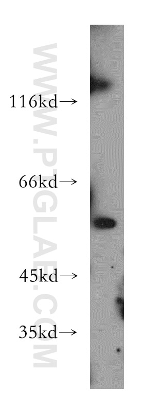 Western Blot (WB) analysis of L02 cells using SLC16A2 Polyclonal antibody (20676-1-AP)