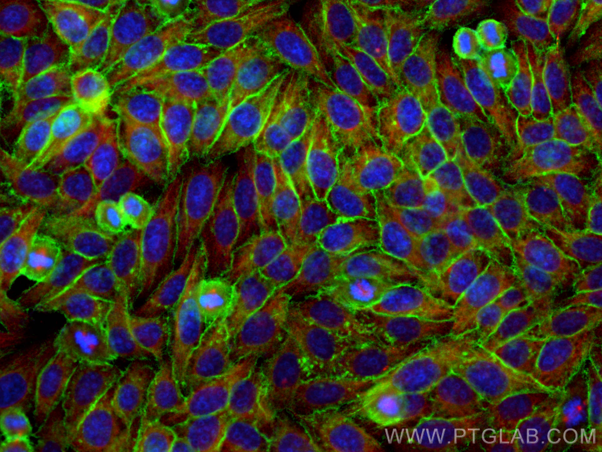 IF Staining of HepG2 using 22787-1-AP