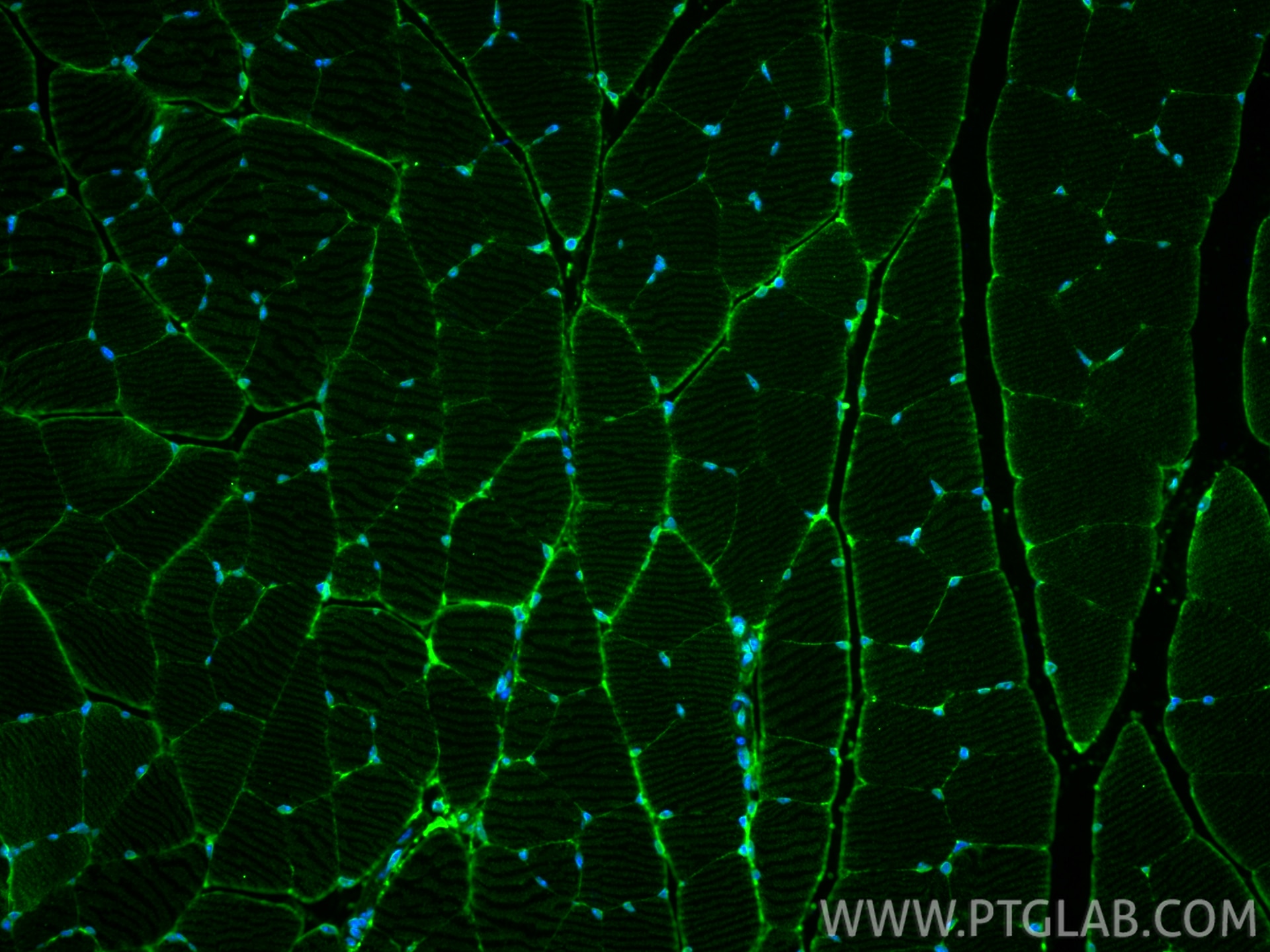IF Staining of mouse skeletal muscle using 22787-1-AP Immunofluorescence (IF) / fluorescent staining of mouse skeletal muscle tissue using MCT4 Polyclonal antibody (22787-1-AP)