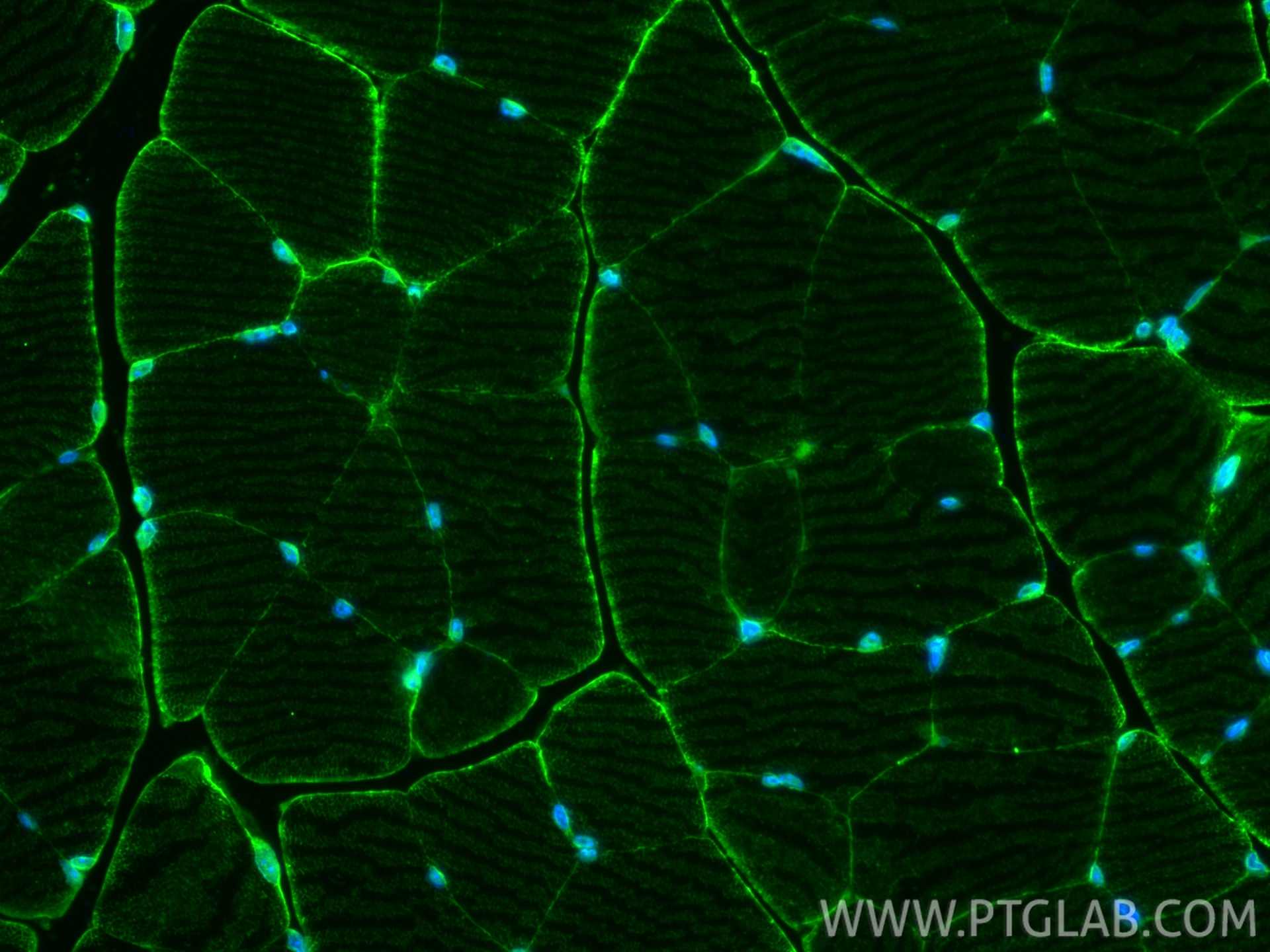 IF Staining of mouse skeletal muscle using 22787-1-AP Immunofluorescence (IF) / fluorescent staining of mouse skeletal muscle tissue using MCT4 Polyclonal antibody (22787-1-AP)