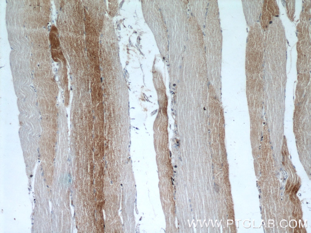 Immunohistochemistry (IHC) staining of human skeletal muscle tissue using MCT4 Polyclonal antibody (22787-1-AP)