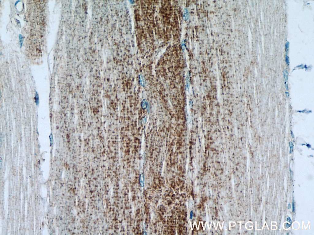 Immunohistochemistry (IHC) staining of human skeletal muscle tissue using MCT4 Polyclonal antibody (22787-1-AP)