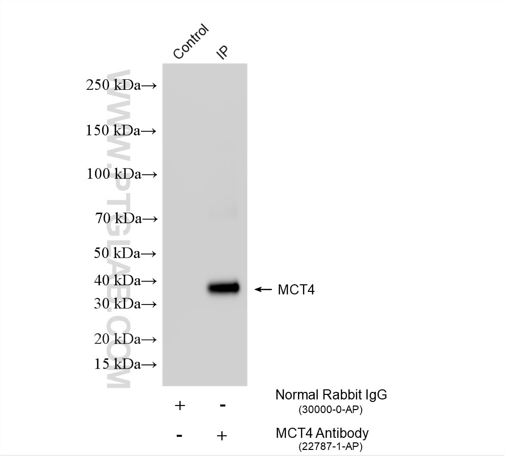 IP experiment of mouse skeletal muscle using 22787-1-AP Immunoprecipitation (IP) experiment of mouse skeletal muscle tissue using MCT4 Polyclonal antibody (22787-1-AP)