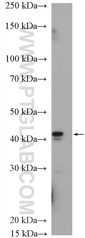 WB analysis of rat skeletal muscle using 22787-1-AP