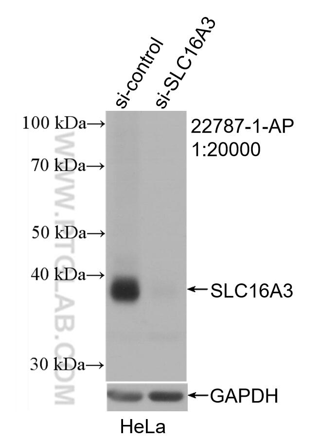 Western Blot (WB) analysis of HeLa cells using MCT4 Polyclonal antibody (22787-1-AP)