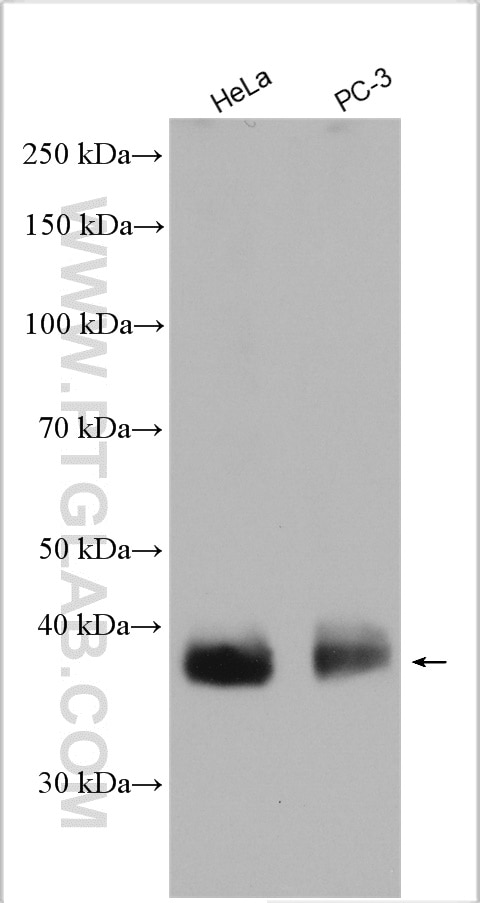 Western Blot (WB) analysis of various lysates using MCT4 Polyclonal antibody (22787-1-AP)