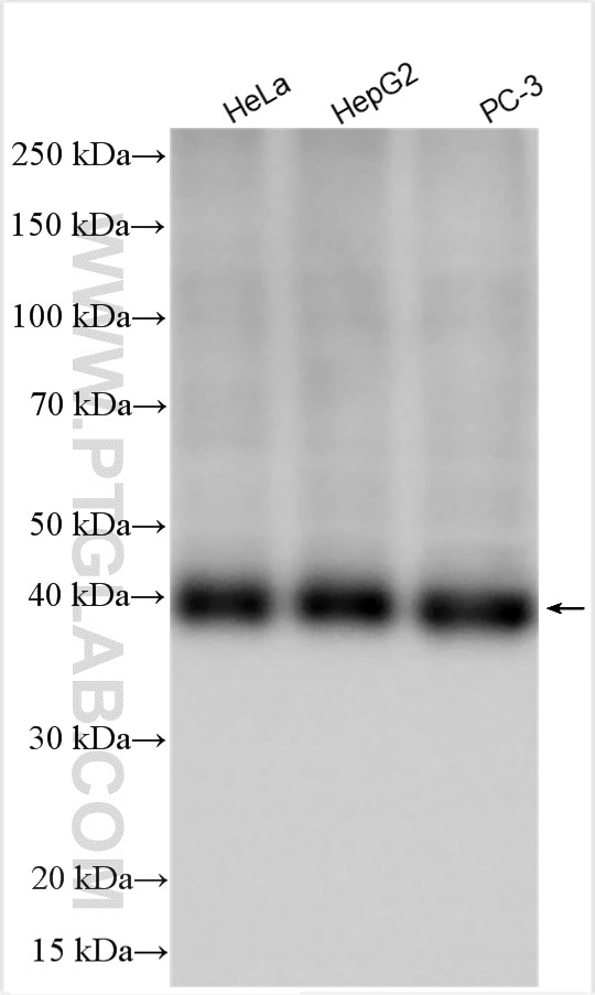 Western Blot (WB) analysis of various lysates using MCT4 Polyclonal antibody (22787-1-AP)