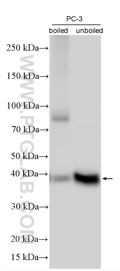 Western Blot (WB) analysis of various lysates using MCT4 Polyclonal antibody (22787-1-AP)