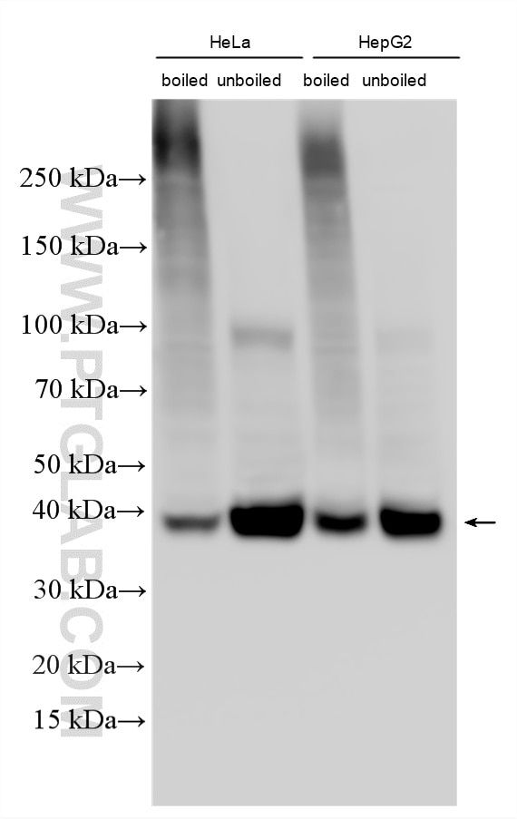 Western Blot (WB) analysis of various lysates using MCT4 Polyclonal antibody (22787-1-AP)