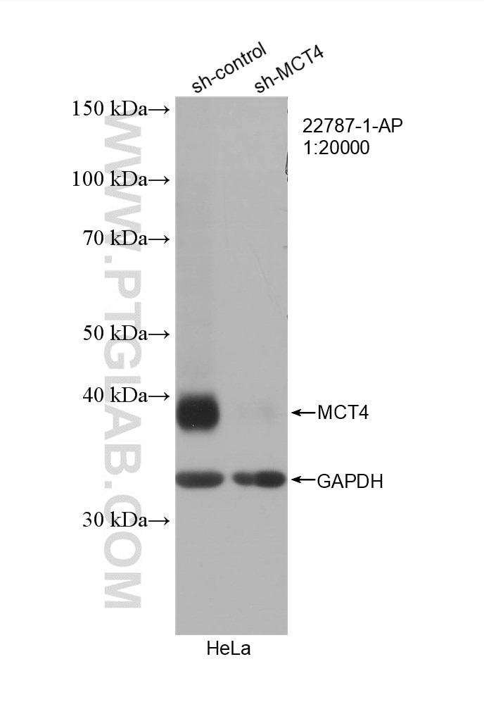 WB analysis of HeLa using 22787-1-AP Western Blot (WB) analysis of HeLa cells using MCT4 Polyclonal antibody (22787-1-AP)