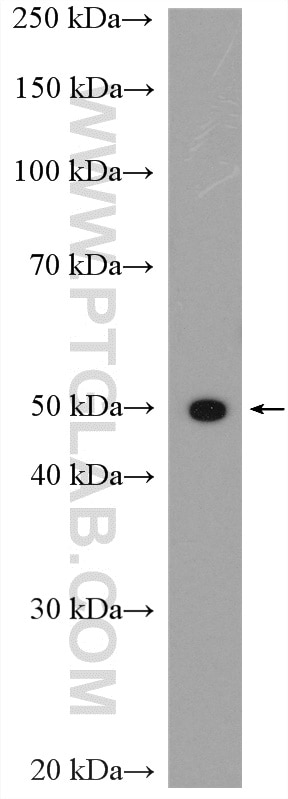 Western Blot (WB) analysis of Jurkat cells using SLC16A4 Polyclonal antibody (20889-1-AP)