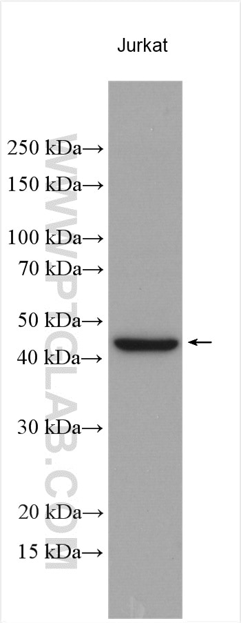Western Blot (WB) analysis of various lysates using SLC16A4 Polyclonal antibody (20889-1-AP)