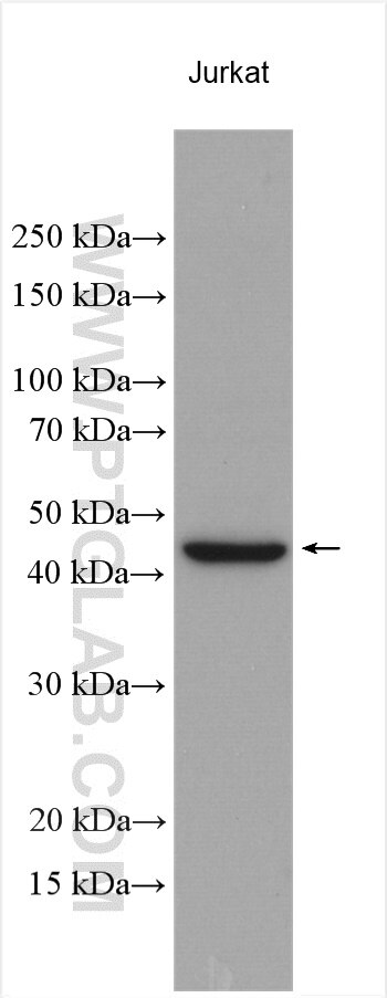 Western Blot (WB) analysis of various lysates using SLC16A4 Polyclonal antibody (20889-1-AP)