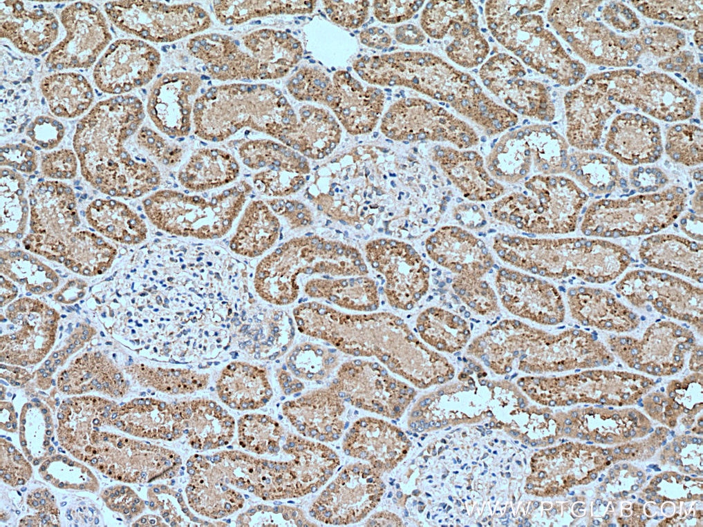 Immunohistochemistry (IHC) staining of human kidney tissue using SLC16A5 Polyclonal antibody (12120-1-AP)