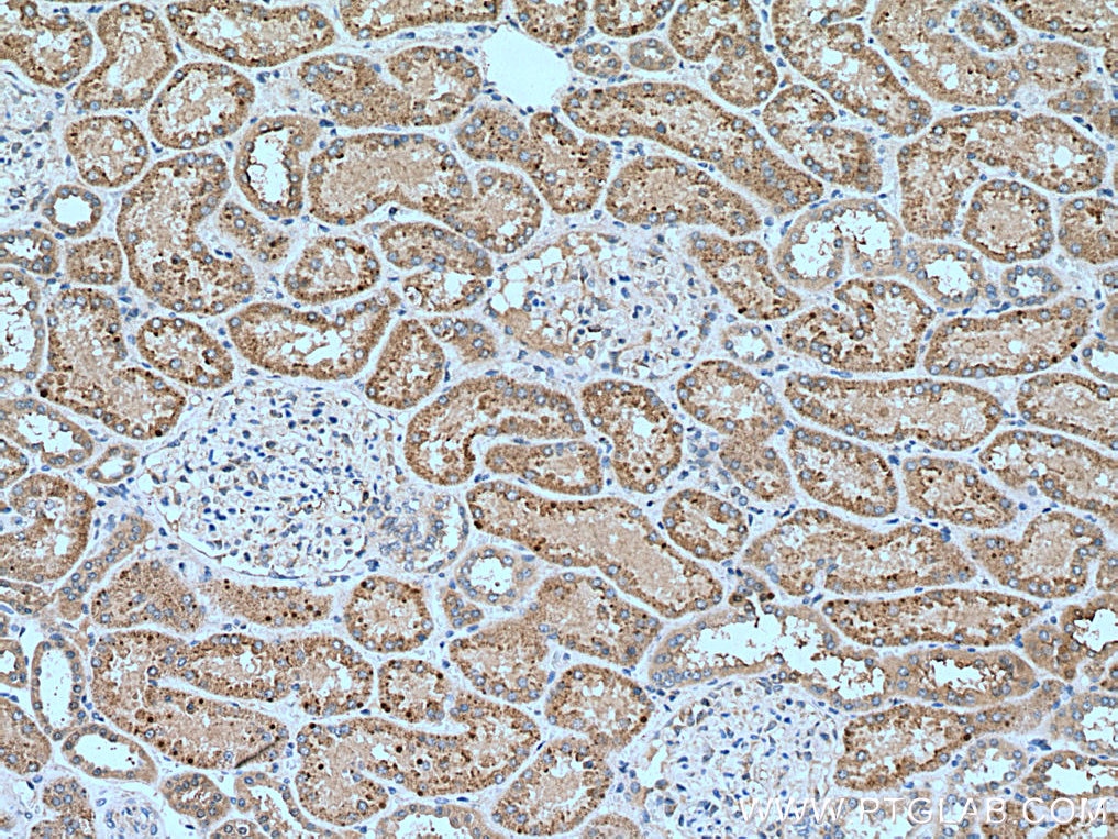 IHC staining of human kidney using 12120-1-AP