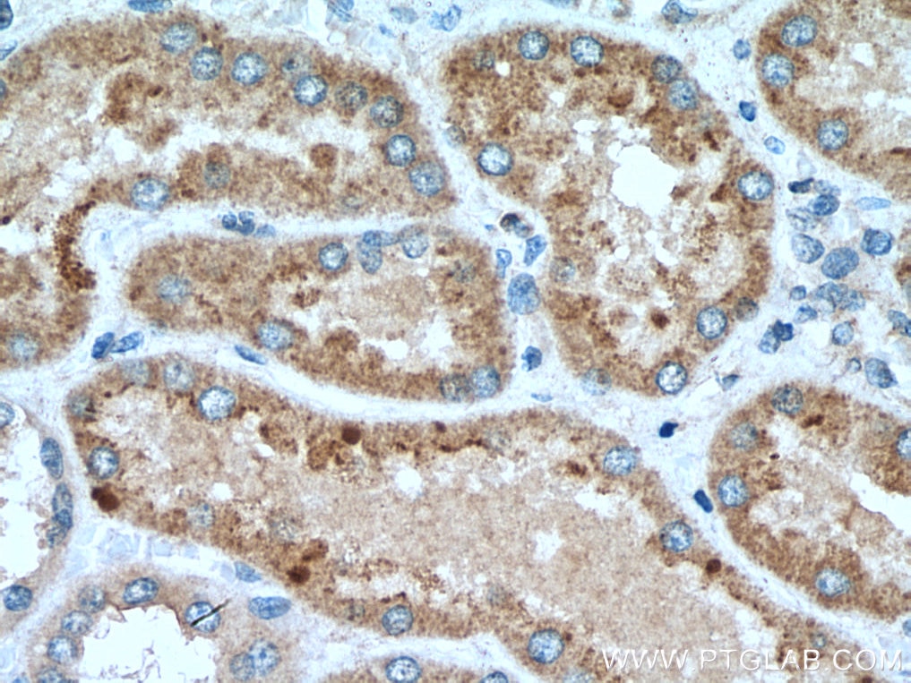 Immunohistochemistry (IHC) staining of human kidney tissue using SLC16A5 Polyclonal antibody (12120-1-AP)