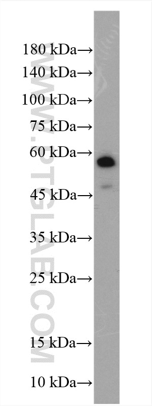 Western Blot (WB) analysis of human placenta tissue using SLC16A5 Polyclonal antibody (12120-1-AP)
