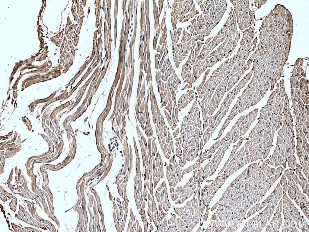 IHC staining of mouse heart using 20355-1-AP
