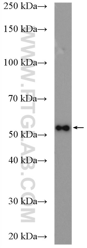 Western Blot (WB) analysis of SH-SY5Y cells using MCT2 Polyclonal antibody (20355-1-AP)
