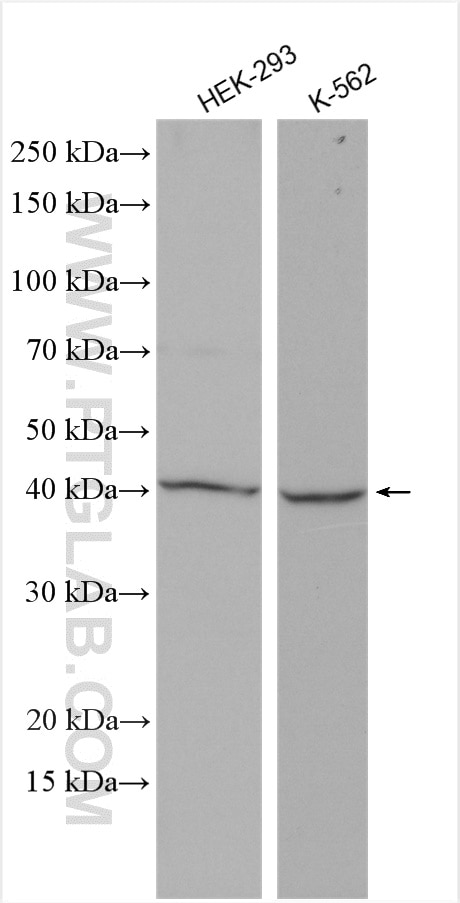 Western Blot (WB) analysis of various lysates using MCT2 Polyclonal antibody (20355-1-AP)