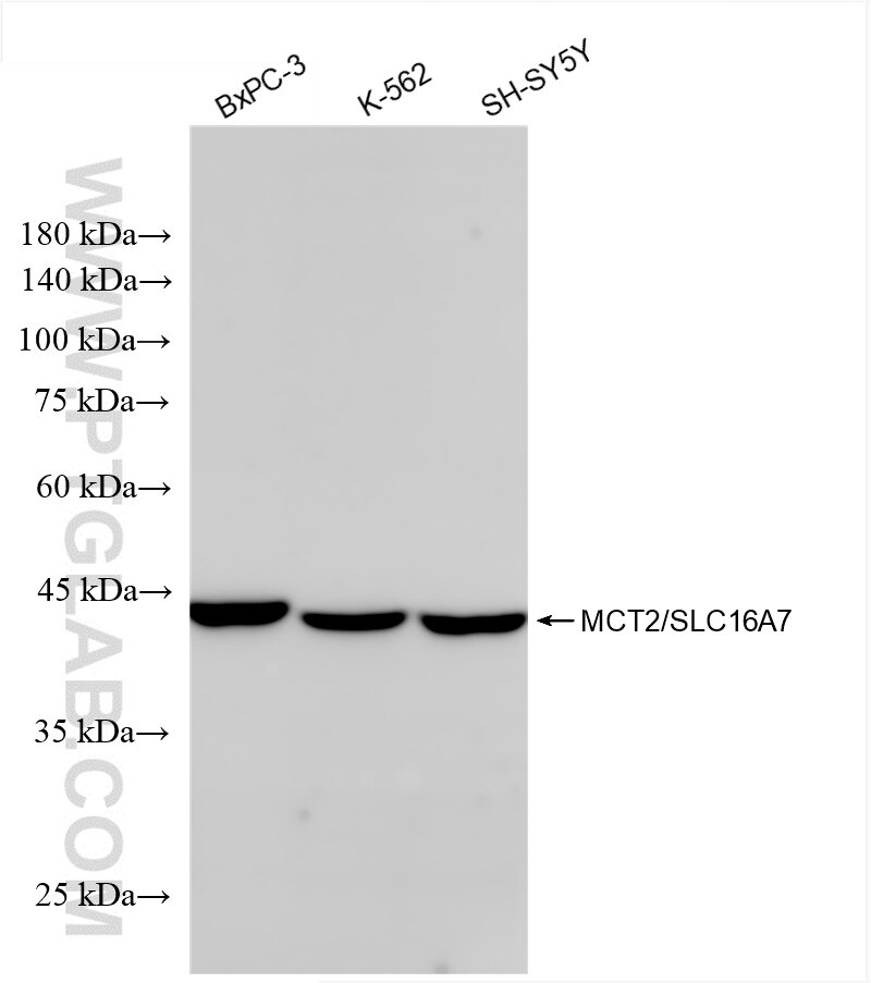 Western Blot (WB) analysis of various lysates using MCT2/SLC16A7 Recombinant antibody (85145-3-RR)