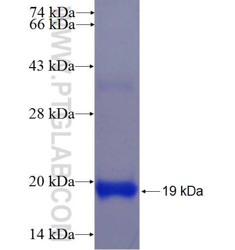 SLC16A9 fusion protein Ag23251 SDS-PAGE