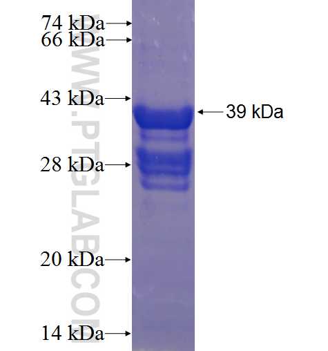 SLC16A9 fusion protein Ag23262 SDS-PAGE