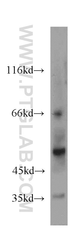 Western Blot (WB) analysis of human placenta tissue using NPT1 Polyclonal antibody (20751-1-AP)