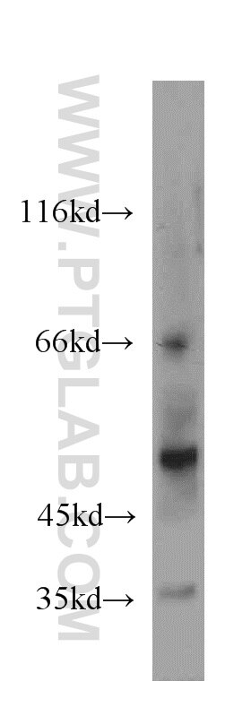 Western Blot (WB) analysis of human placenta tissue using NPT1 Polyclonal antibody (20751-1-AP)