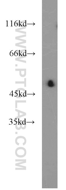 WB analysis of mouse kidney using 20751-1-AP