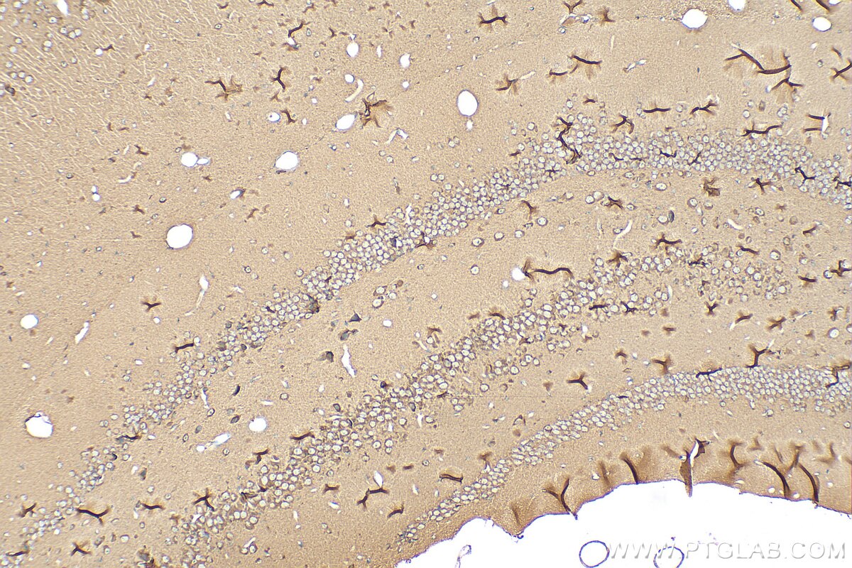 Immunohistochemistry (IHC) staining of mouse brain tissue using SLC17A2 Polyclonal antibody (18077-1-AP)
