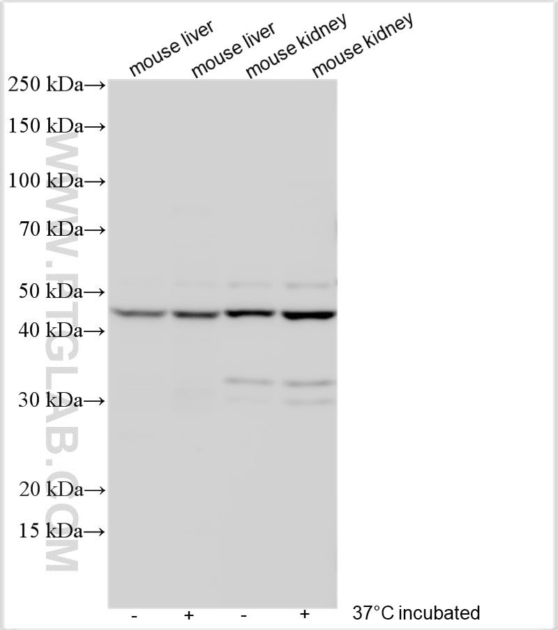 Western Blot (WB) analysis of various lysates using SLC17A2 Polyclonal antibody (18077-1-AP)