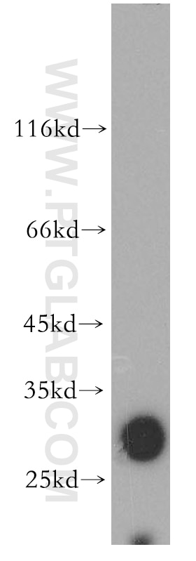 Western Blot (WB) analysis of HEK-293 cells using SLC17A5 Polyclonal antibody (13320-1-AP)