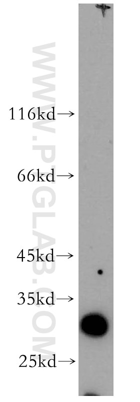Western Blot (WB) analysis of human kidney tissue using SLC17A5 Polyclonal antibody (13320-1-AP)