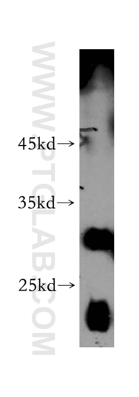 SLC17A5