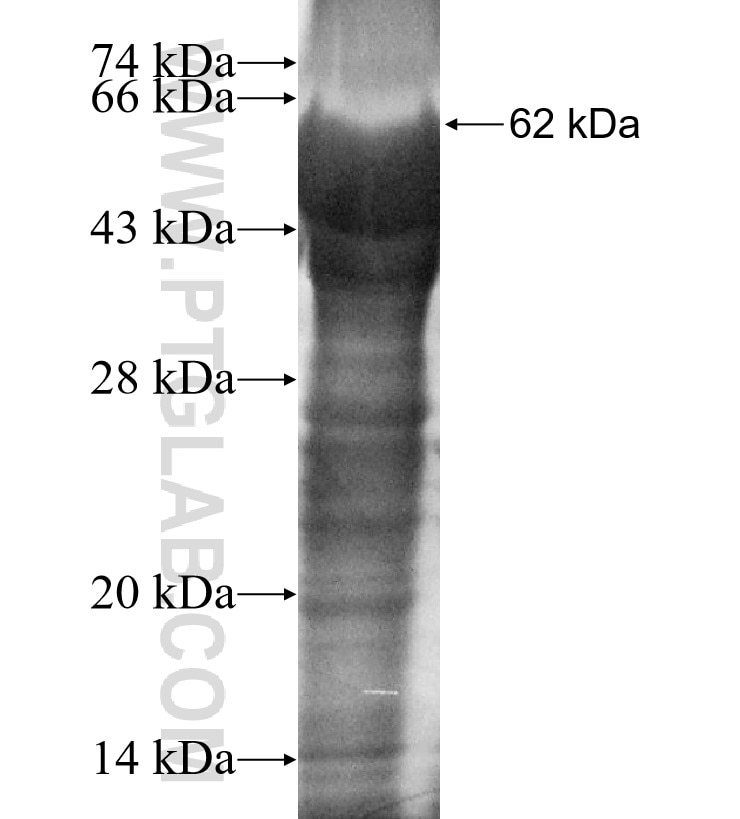 SLC17A5 fusion protein Ag3855 SDS-PAGE