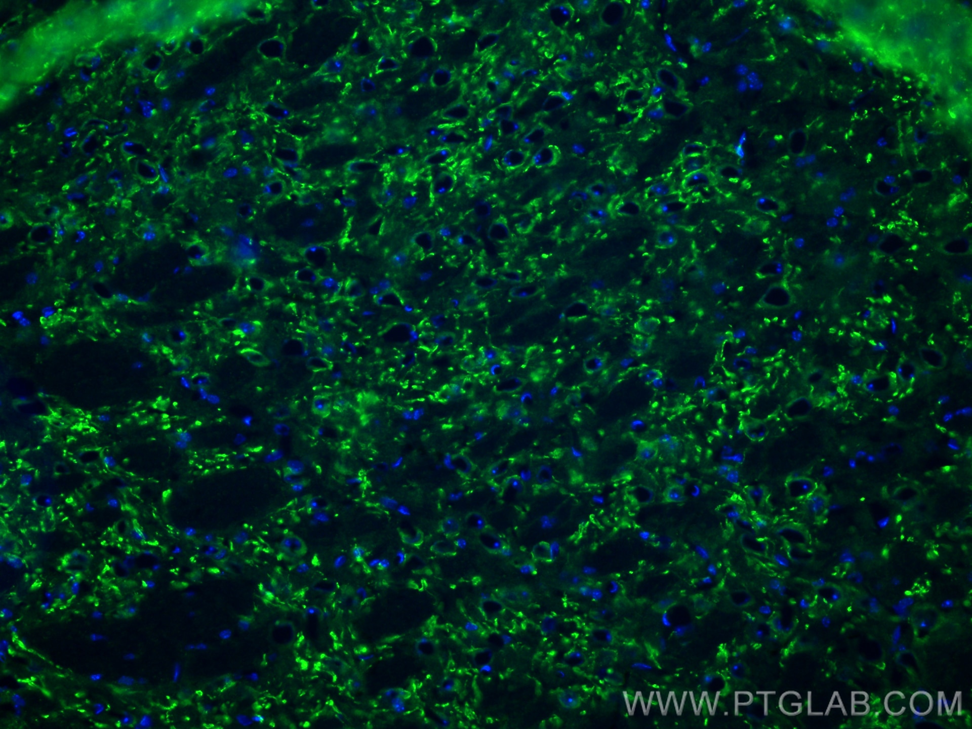 Immunofluorescence (IF) / fluorescent staining of mouse brain tissue using VGLUT2 Recombinant antibody (84083-2-RR)