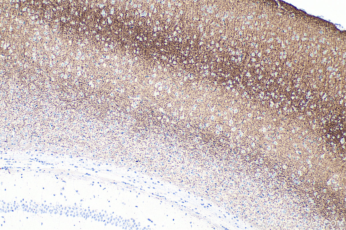 Immunohistochemical analysis of paraffin-embedded mouse brain tissue slide using 84083-2-RR (VGLUT2 antibody) at dilution of 1:2000 (under 10x lens). Heat mediated antigen retrieval with Tris-EDTA buffer (pH 9.0). Immunohistochemistry (IHC) staining of mouse brain tissue using VGLUT2 Recombinant monoclonal antibody (84083-2-RR)