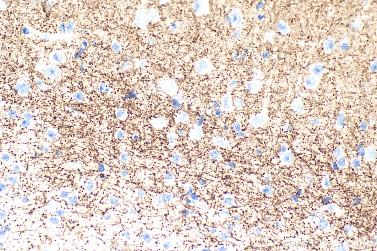 Immunohistochemical analysis of paraffin-embedded mouse brain tissue slide using 84083-2-RR (VGLUT2 antibody) at dilution of 1:2000 (under 40x lens). Heat mediated antigen retrieval with Tris-EDTA buffer (pH 9.0). Immunohistochemistry (IHC) staining of mouse brain tissue using VGLUT2 Recombinant monoclonal antibody (84083-2-RR)