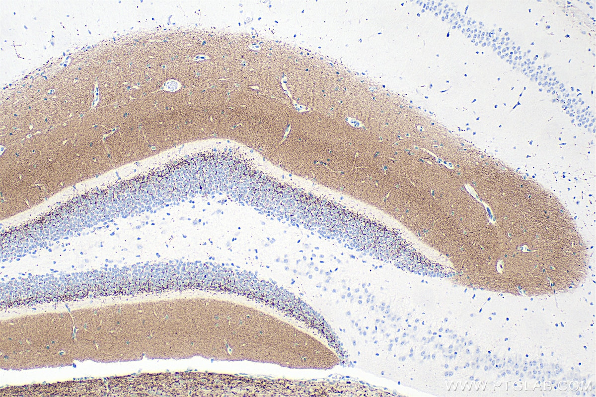 Immunohistochemical analysis of paraffin-embedded mouse brain tissue slide using 84083-2-RR (VGLUT2 antibody) at dilution of 1:2000 (under 10x lens). Heat mediated antigen retrieval with Tris-EDTA buffer (pH 9.0). Immunohistochemistry (IHC) staining of mouse brain tissue using VGLUT2 Recombinant monoclonal antibody (84083-2-RR)