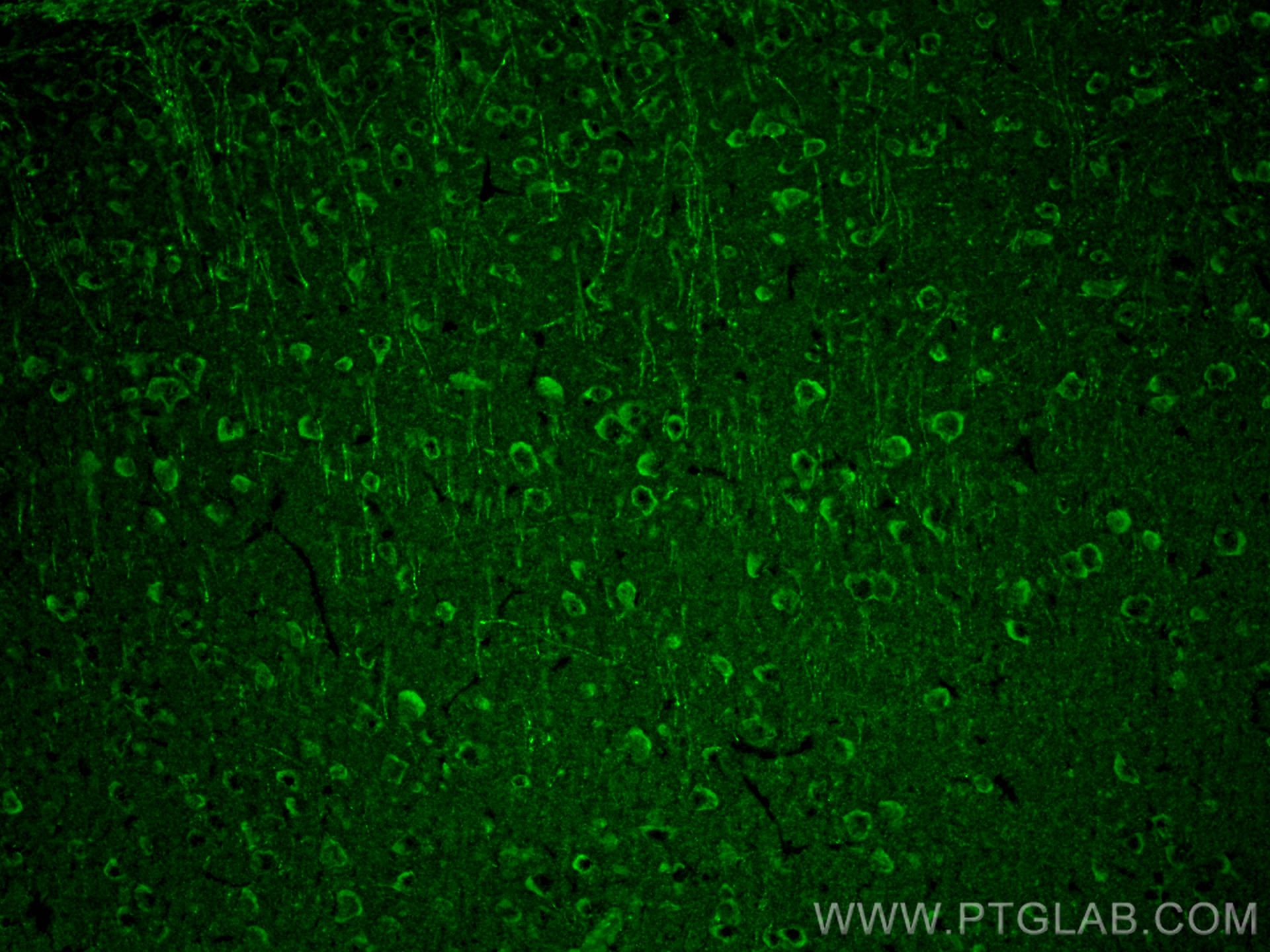 Immunofluorescence (IF) / fluorescent staining of mouse brain tissue using VGLUT1 Polyclonal antibody (55491-1-AP)