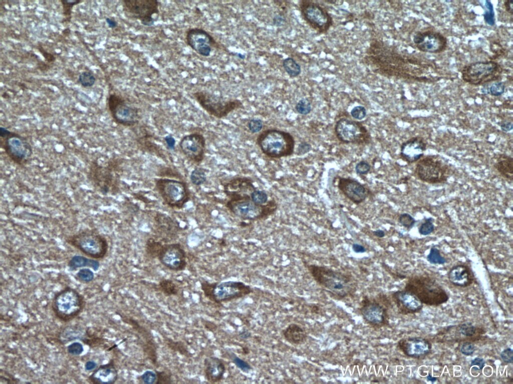 IHC staining of rat brain using 55491-1-AP