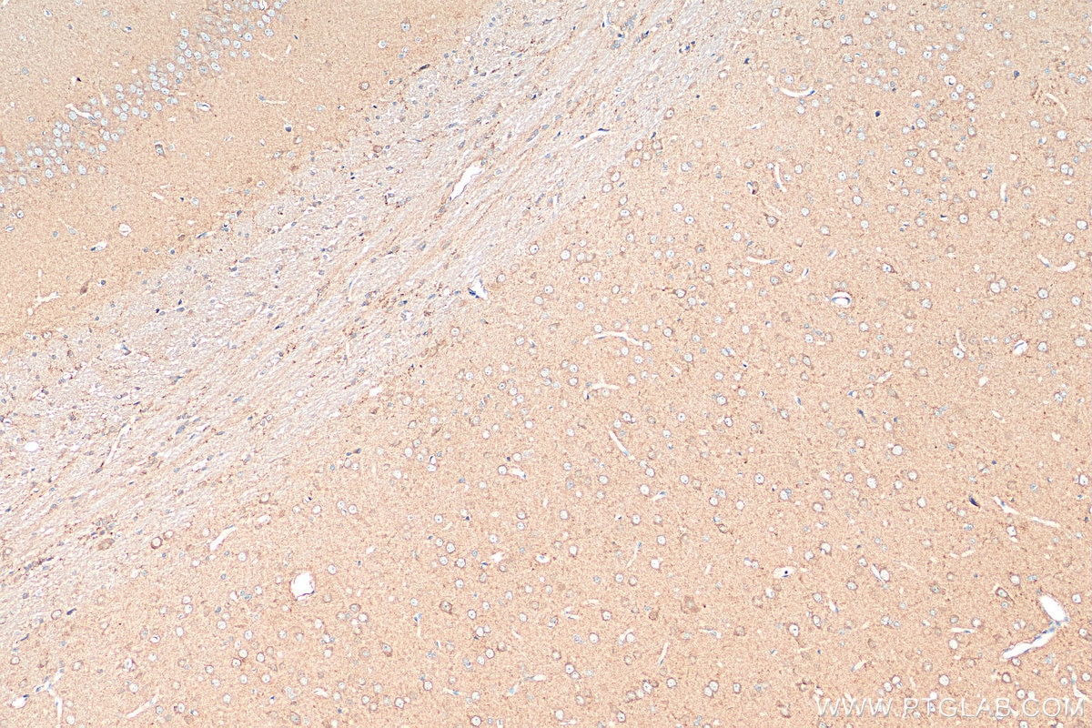 Immunohistochemistry (IHC) staining of rat brain tissue using VGLUT1 Polyclonal antibody (55491-1-AP)