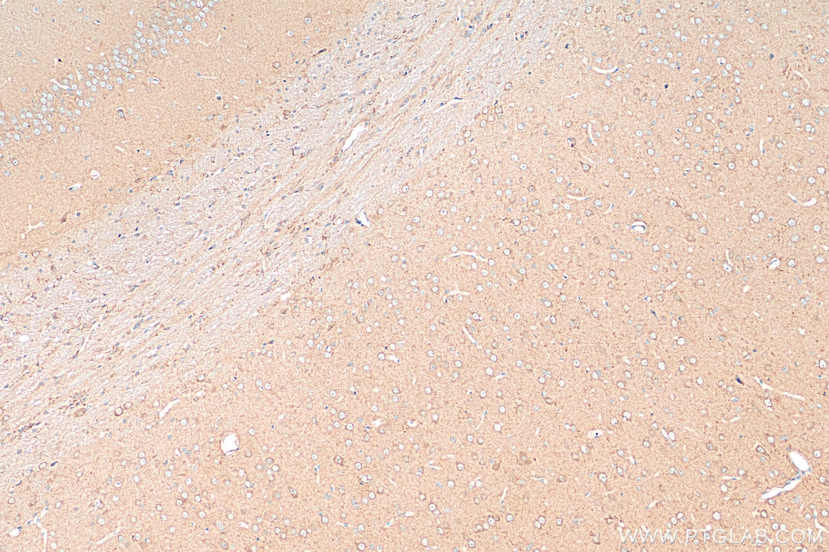 IHC staining of rat brain using 55491-1-AP