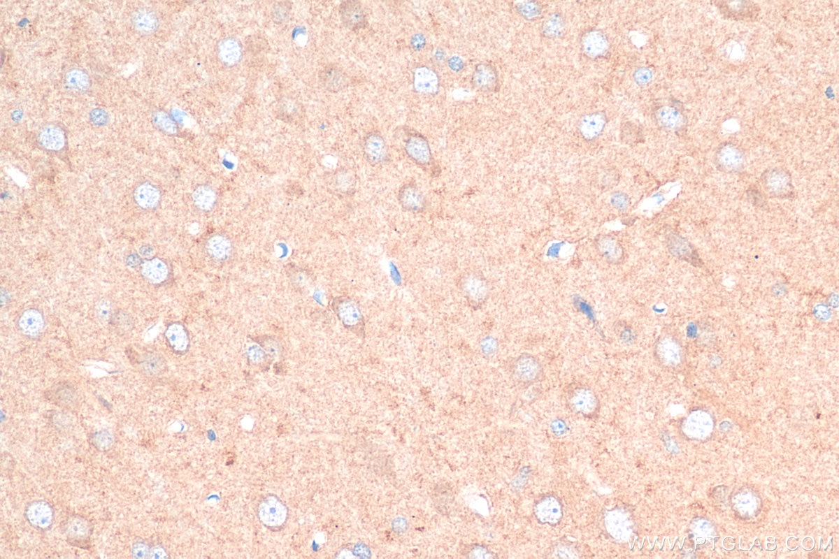 Immunohistochemistry (IHC) staining of rat brain tissue using VGLUT1 Polyclonal antibody (55491-1-AP)