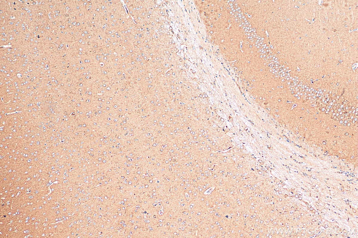 Immunohistochemistry (IHC) staining of mouse brain tissue using VGLUT1 Polyclonal antibody (55491-1-AP)
