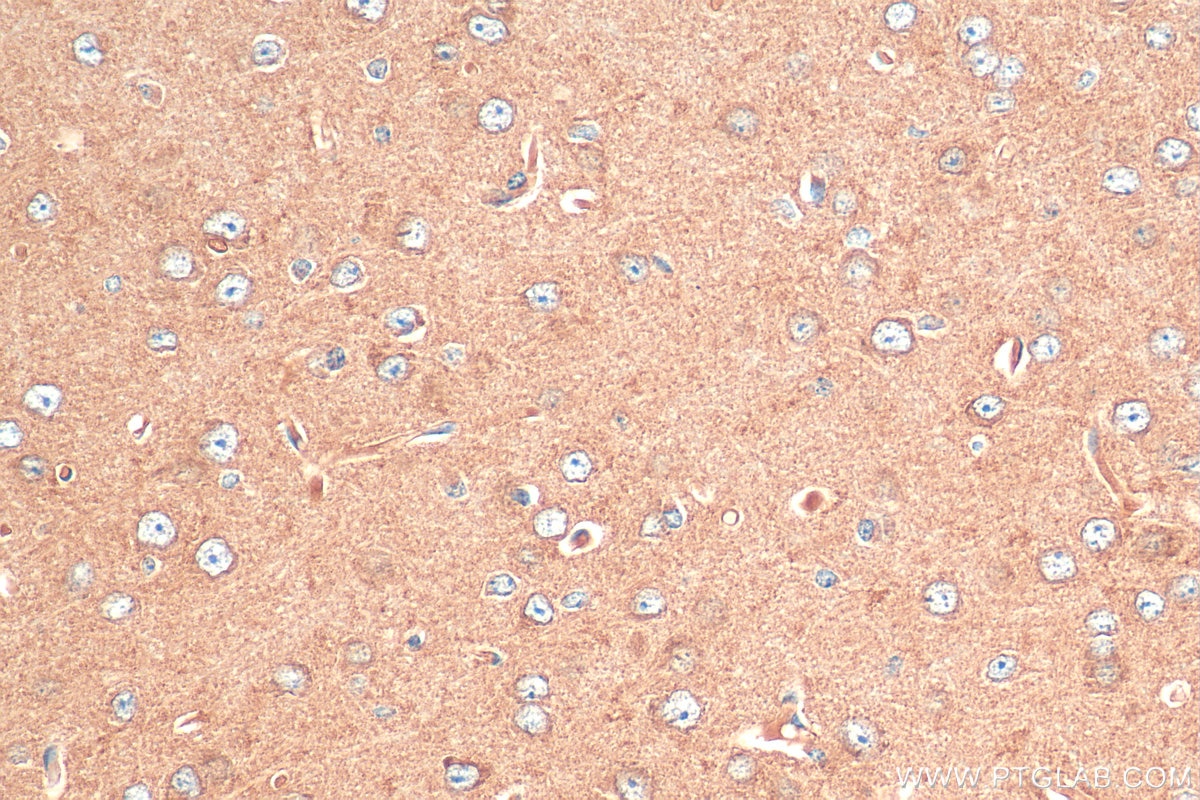 Immunohistochemistry (IHC) staining of mouse brain tissue using VGLUT1 Polyclonal antibody (55491-1-AP)